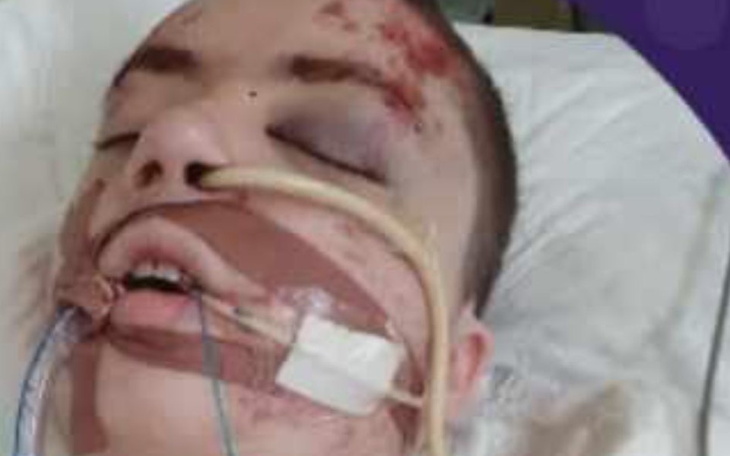 Zbiórka HARD ADV FAMILIA dla Małolata - zdjęcie główne