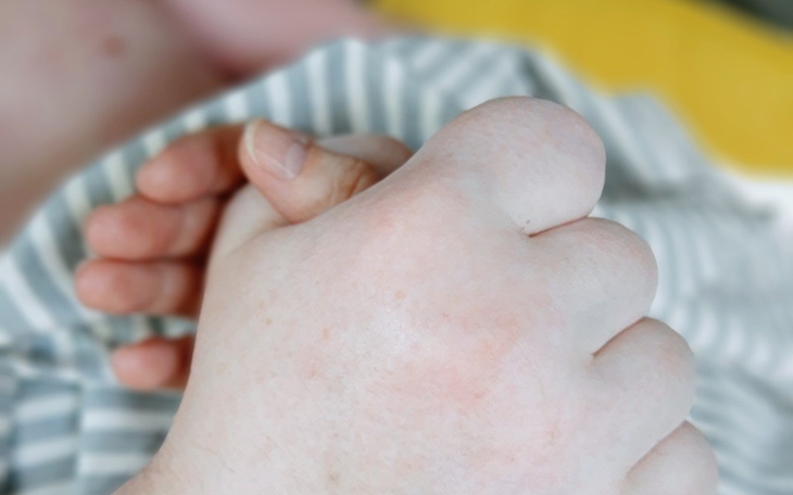 Zbiórka Piąta bitwa z rakiem - zdjęcie główne