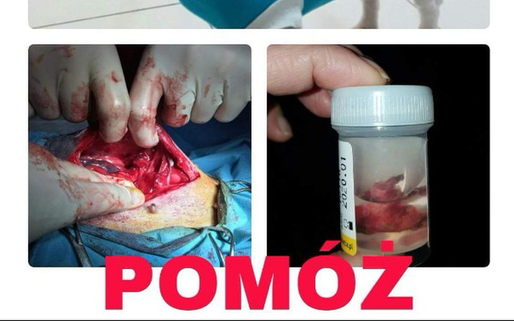 Zbiórka Lula zapłaciła za BŁĘDY LEKARZA - zdjęcie główne