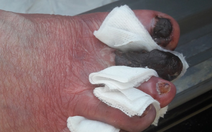 Zbiórka Ścieżką chorą osobę - zdjęcie główne