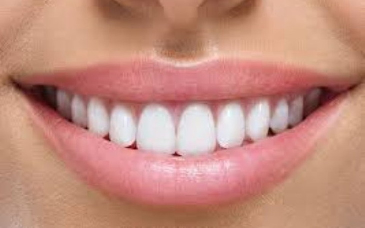 Zbiórka wstawienie zebów żonie - zdjęcie główne