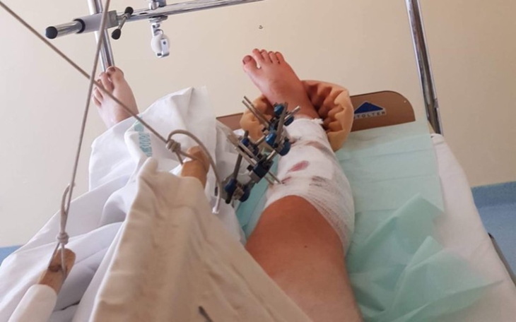 Zbiórka Pomóż mi wrócić do sprawności! - zdjęcie główne