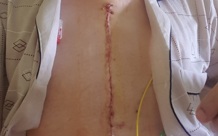 Zbiórka Krzepliwosc Krwi Urządzenie życi - zdjęcie główne