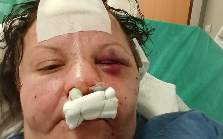 Osoba po wypadku, wymaga pomocy medycznej.