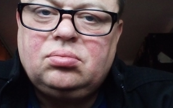 Zbiórka Po UDARZE SAM ale U SIEBIE - zdjęcie główne