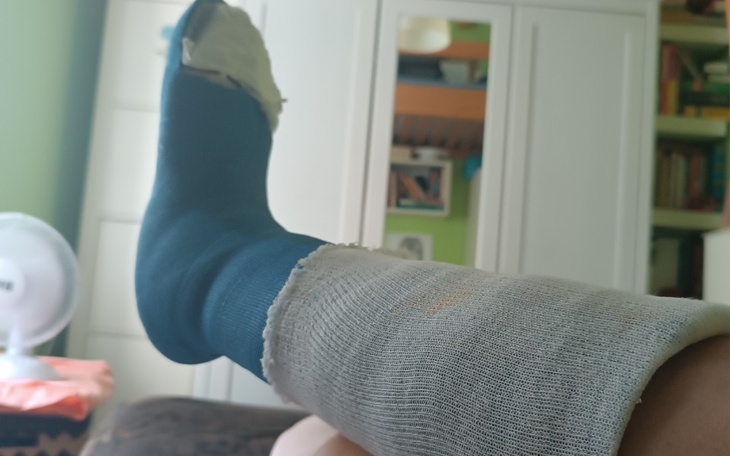 Zbiórka Perpetum mobile połamanej nogi - zdjęcie główne