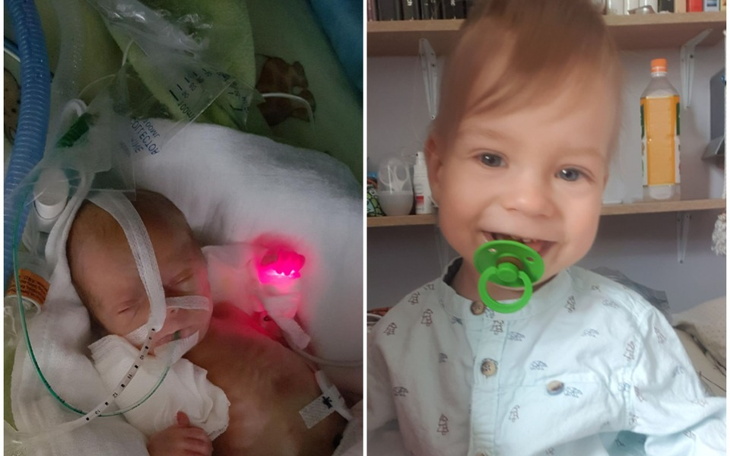 Zbiórka Chrońmy Jaśka przed RSV - zdjęcie główne