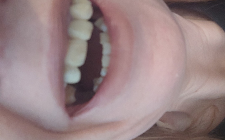 Zbiórka Na wkład korzeniowy, korona , - zdjęcie główne