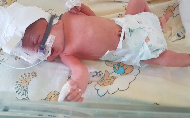 Zbiórka Leczenie i rehabilitację Marcela - zdjęcie główne