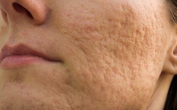 Zbiórka Moje ważne marzenie - zdjęcie główne