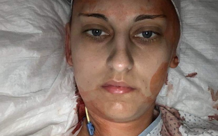 Zbiórka Leczenie Glejaka 4stopnia - zdjęcie główne