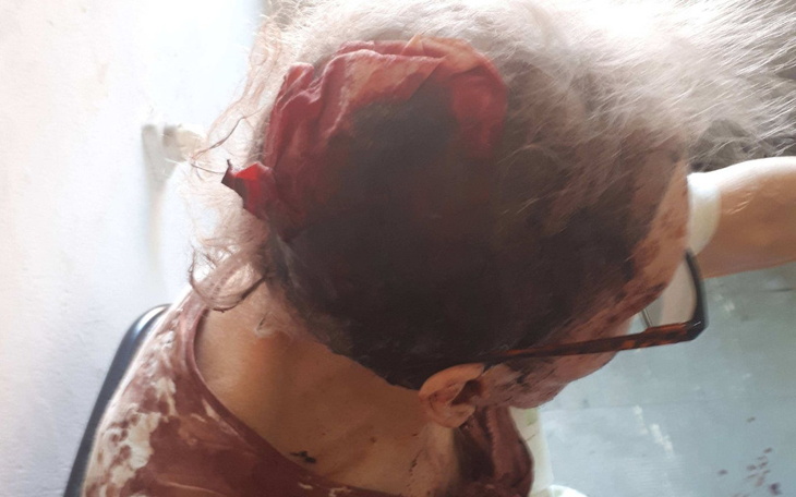 Zbiórka Godne życie z parkinsonem - zdjęcie główne