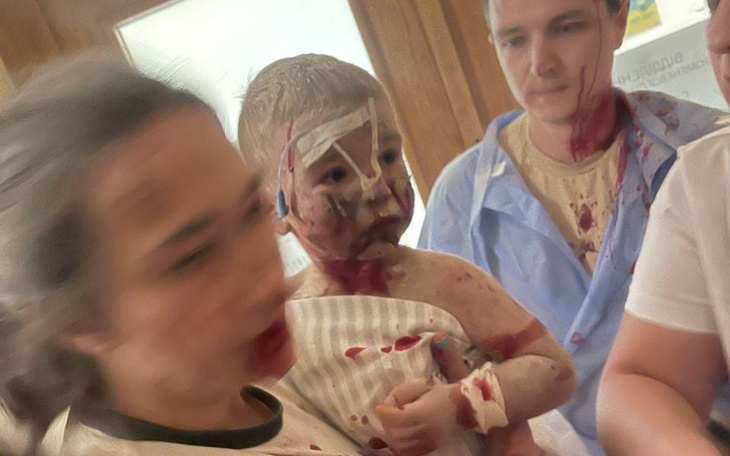 Zbiórka Pomóc Szpitalowi Ochmatdyt - zdjęcie główne