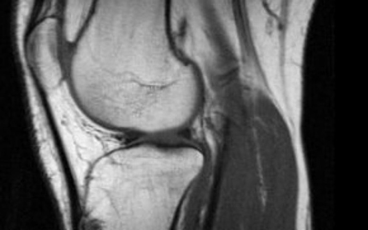 Zbiórka Zawiążmy moje kolano! - zdjęcie główne