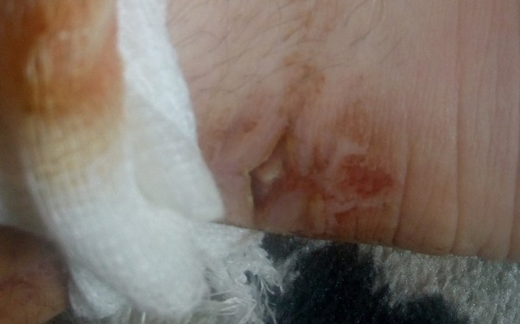 Zbiórka Rehabilitacja nogi leczenie - zdjęcie główne