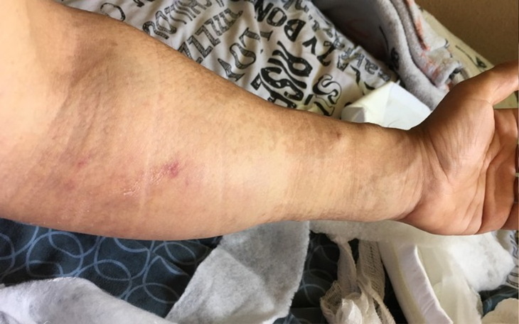 Zbiórka Kosztowna operacja lewej ręki. - zdjęcie główne