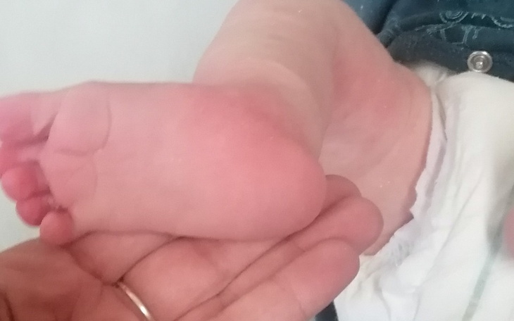 Zbiórka Powrót do normalności dla Leosia - zdjęcie główne