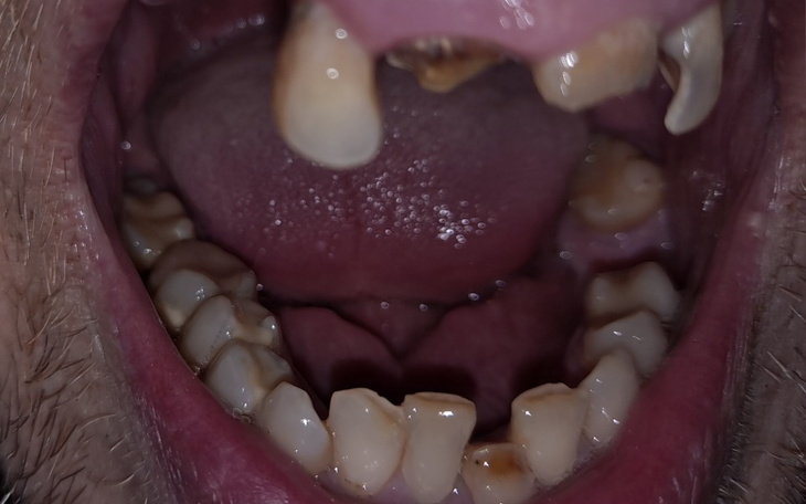 Zbiórka Proteza oraz leczenie - zdjęcie główne