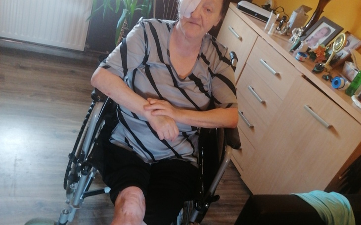 Zbiórka Zbieram dla babci protezę nog - zdjęcie główne