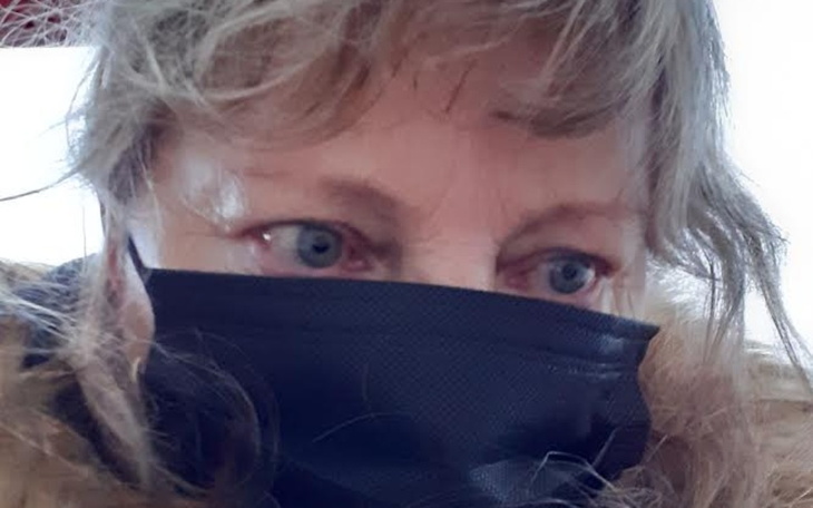 Zbiórka Na przeszczep siatkówki - zdjęcie główne