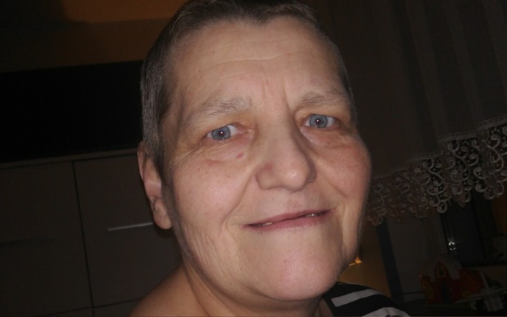 Zbiórka Leczenie stomatologiczne po chem - zdjęcie główne