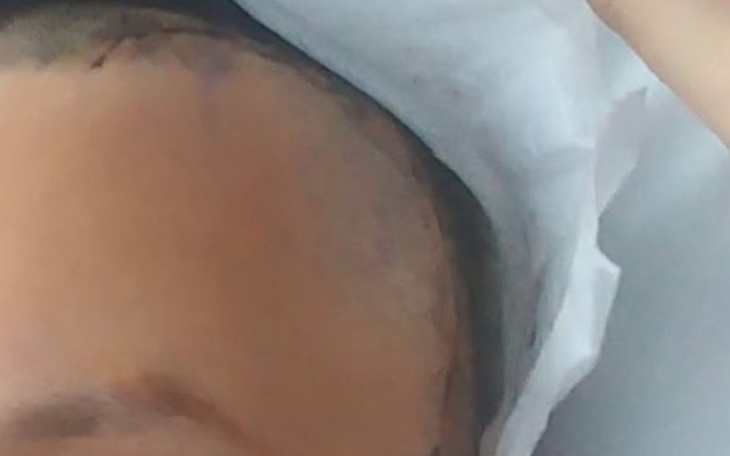 Zbiórka Jestem po operacji głowy - zdjęcie główne