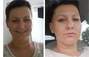 Zbiórka Pomóżmy Kamili w walce z chorobą - miniaturka zdjęcia