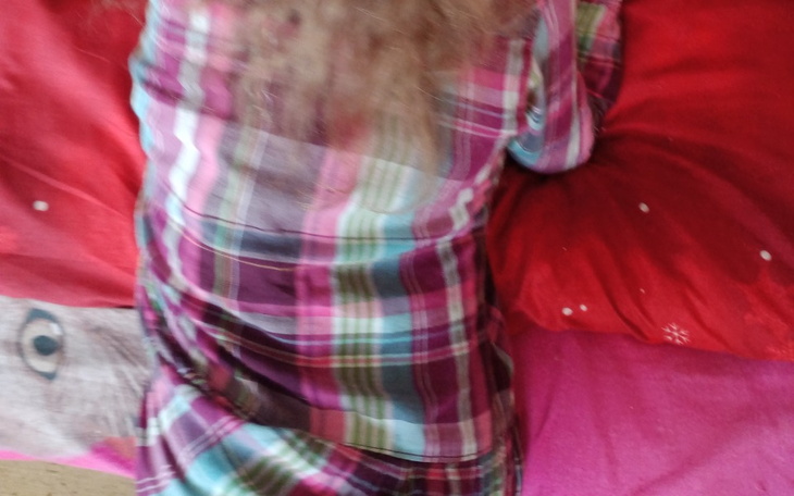 Zbiórka Na operacje Oli - zdjęcie główne