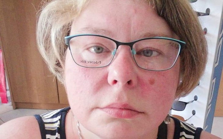 Zbiórka Pomoc dla Anny - zdjęcie główne