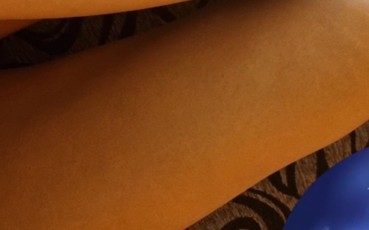 Zbiórka Zbiórka na rehabilitację kolana - zdjęcie główne