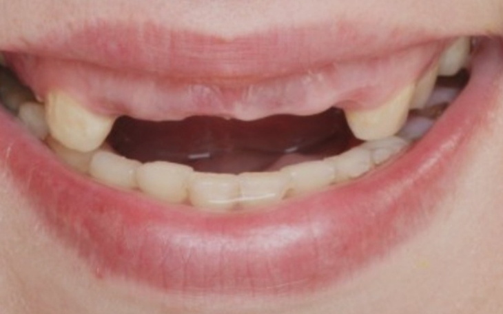 Zbiórka Nowe zęby - nowe życie - zdjęcie główne