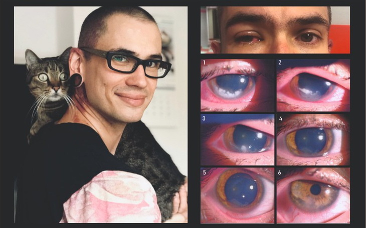 Zbiórka Ameba śmiertelne zagrożenie ! - zdjęcie główne