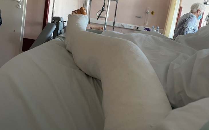 Złamana noga w gipsie na łóżku szpitalnym.