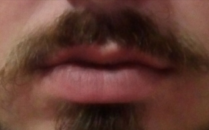 Zbiórka Możliwość ponownego uśmiechu - zdjęcie główne