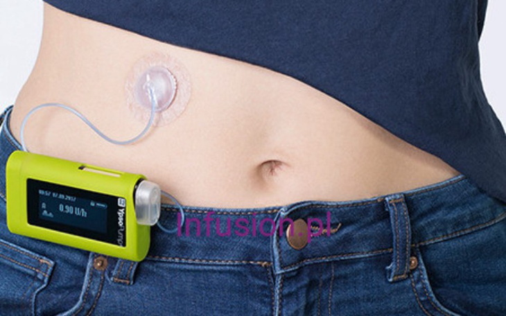 Zbiórka Pompa insulinowa cukrzyca I - zdjęcie główne