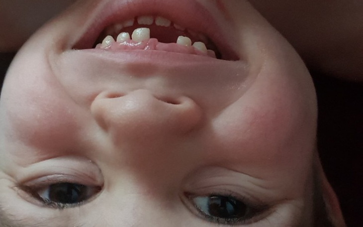 Zbiórka Leczenie Julka - zdjęcie główne