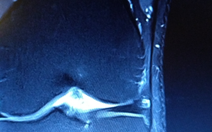 Obraz z MRI, ukazujący szczegóły anatomiczne.