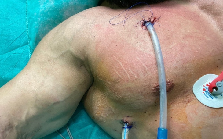 Zbiórka Operacja bicepsa - zdjęcie główne