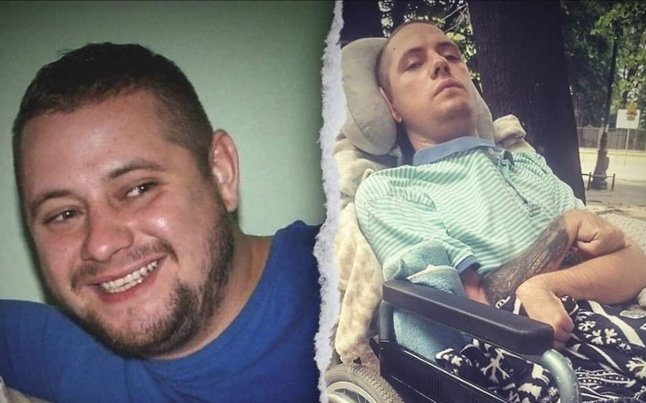 Mężczyzna przed i po wypadku, ukazujący zmiany w jego życiu.