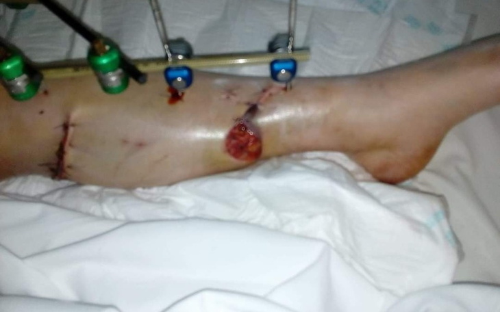 Zbiórka Operacja nogi mojej narzeczonej. - zdjęcie główne