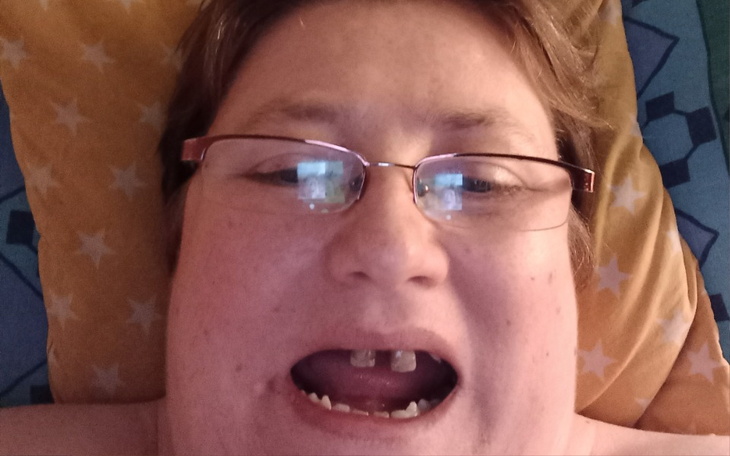 Zbiórka Żeby leczenie - zdjęcie główne