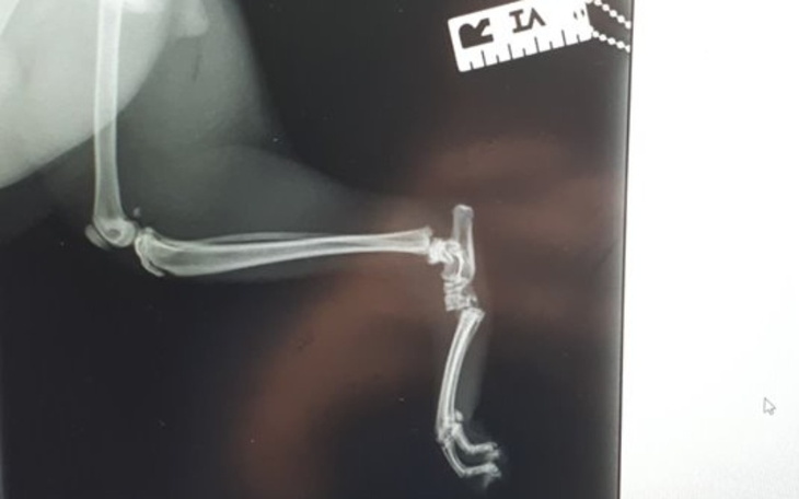 Zbiórka Operacja rekonstrukcji stopy - zdjęcie główne