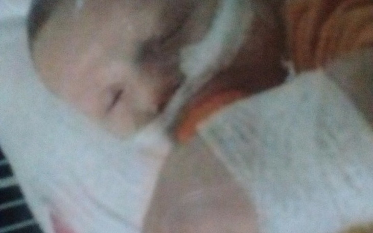 Zbiórka Leczenie Kacperka - zdjęcie główne