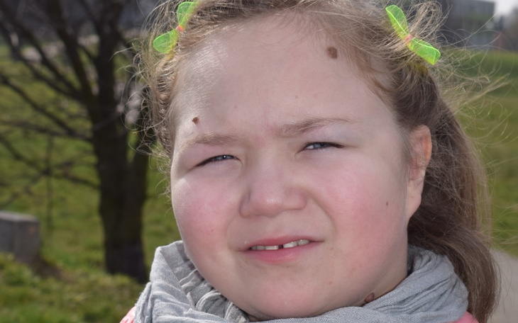 Portret dziewczynki z zielonymi kokardkami w włosach, na tle zieleni.