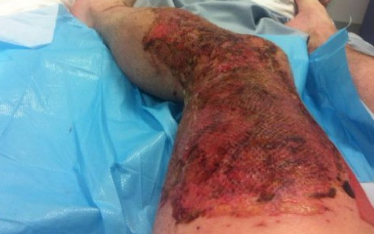 Zbiórka Rehabilitacja po wypadku Syna - zdjęcie główne