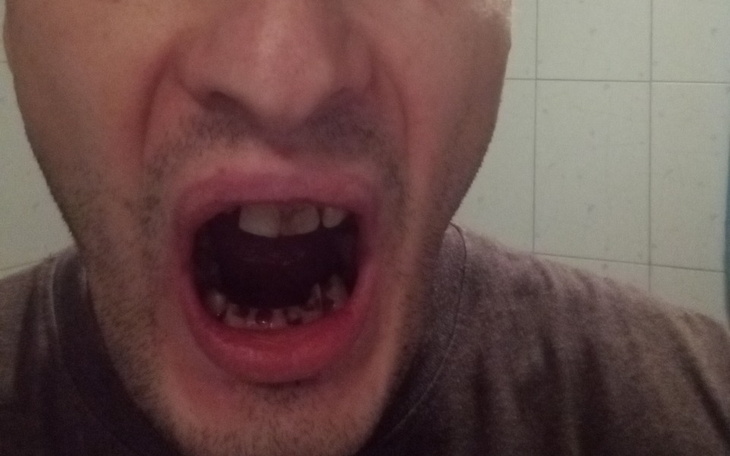 Mężczyzna z otwartą buzią, pokazujący zęby.