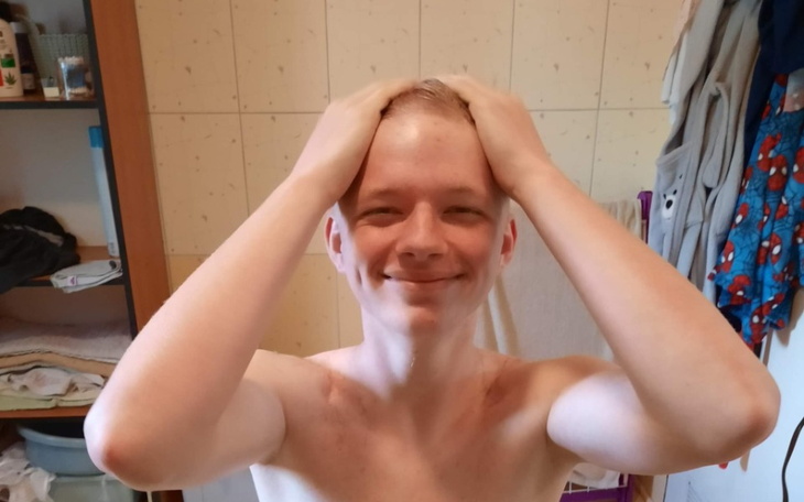 Zbiórka Przeszczep włosów w Turcji - zdjęcie główne