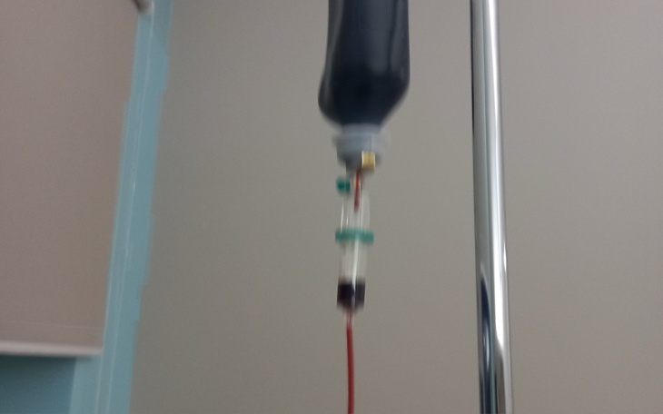 Kroplówka w szpitalu, z widocznym płynem infuzyjnym.