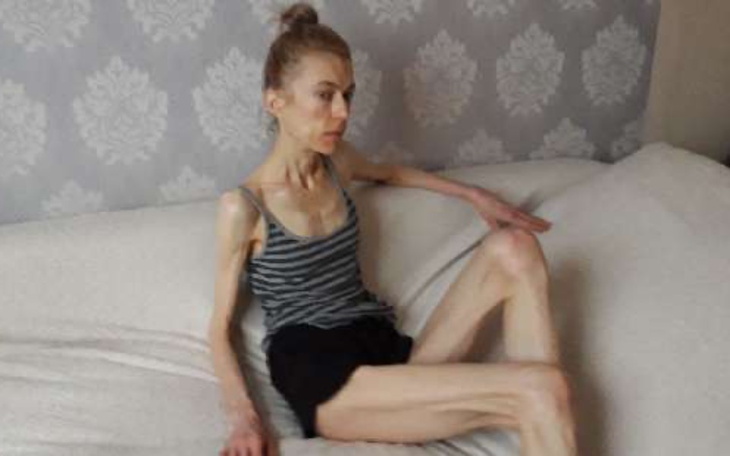 Bardzo wychudzona kobieta siedząca na kanapie.