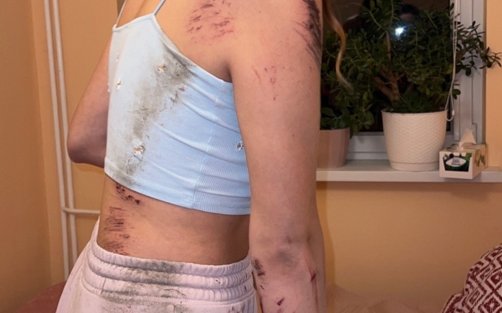 Zbiórka Wypadek samochodowy, operacja - zdjęcie główne